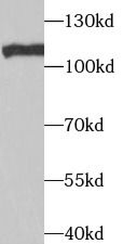 TAF1C Rabbit Polyclonal Antibody