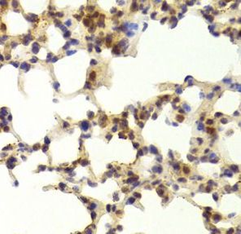 TAF1C Rabbit Polyclonal Antibody