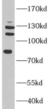 TAF3 Rabbit Polyclonal Antibody