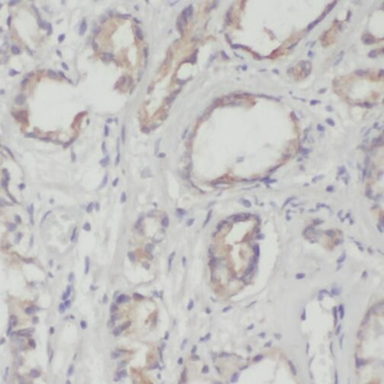 NR2C2 Antibody