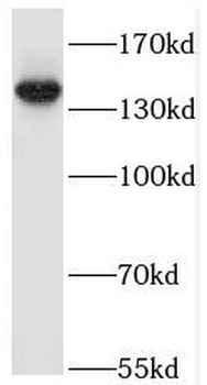 TAOK2 Rabbit Polyclonal Antibody