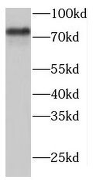 TARS2 Rabbit Polyclonal Antibody