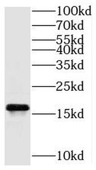 TAX1BP3 Rabbit Polyclonal Antibody