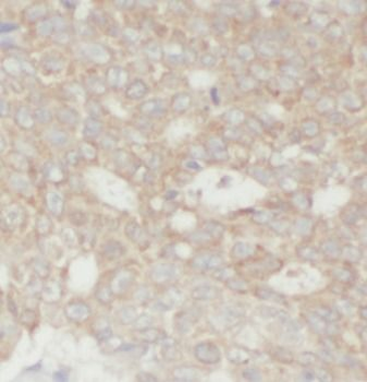 WWTR1 Antibody