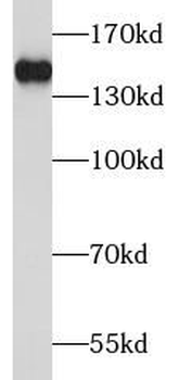 TBC1D1 Antibody