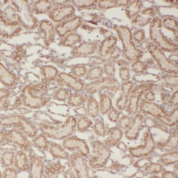 TBC1D1 Antibody