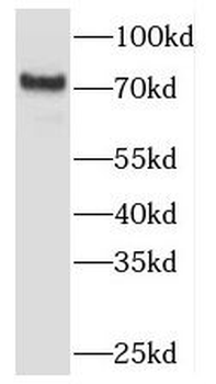 TBC1D23 Rabbit Polyclonal Antibody