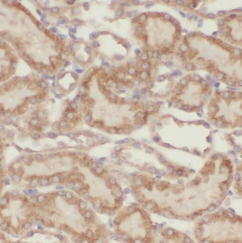 TBC1D23 Rabbit Polyclonal Antibody