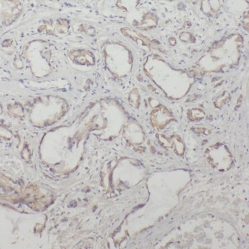 TBCE Antibody