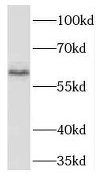 TBX21 Rabbit Polyclonal Antibody