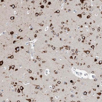 TCEA1 Rabbit Polyclonal Antibody