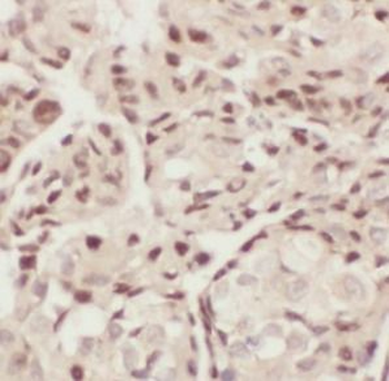 ELOC Rabbit Polyclonal Antibody