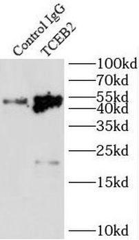 ELOB Rabbit Polyclonal Antibody