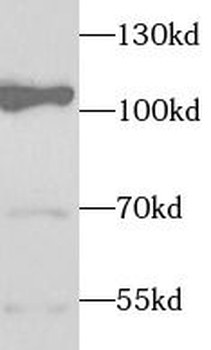 ELOA Rabbit Polyclonal Antibody