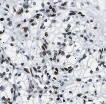 ELOA Rabbit Polyclonal Antibody