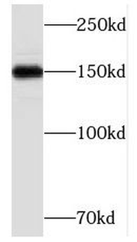 TCERG1 Rabbit Polyclonal Antibody