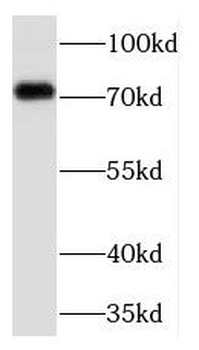 TCF12 Rabbit Polyclonal Antibody