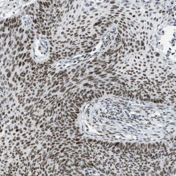 TCF12 Rabbit Polyclonal Antibody