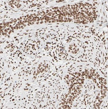 TCF7L1 Antibody