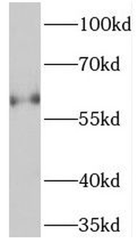 TCHP Rabbit Polyclonal Antibody