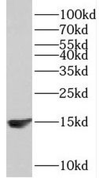 TCL1A Rabbit Polyclonal Antibody