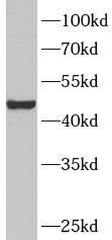 TDO2 Rabbit Polyclonal Antibody