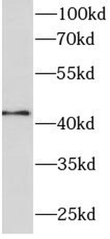 TARDBP Mouse Monoclonal Antibody