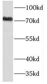 TDRD3 Antibody