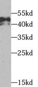 TEAD1 Rabbit Polyclonal Antibody