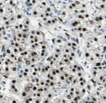 TEAD1 Rabbit Polyclonal Antibody