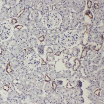 CD248 Antibody
