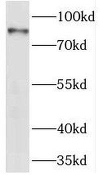 ANTXR1 Rabbit Polyclonal Antibody