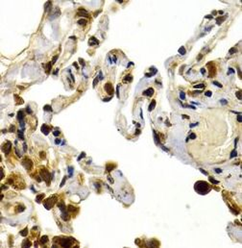 TFDP1 Rabbit Polyclonal Antibody
