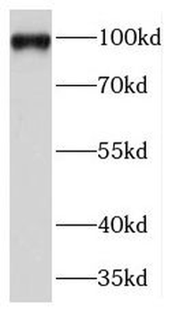 TFIP11 Antibody