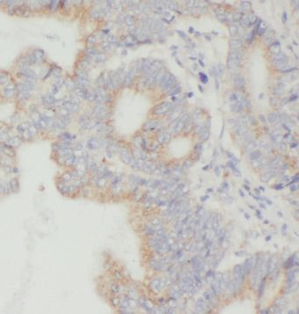 TGFBI Antibody