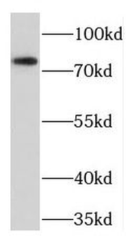 TGFBRAP1 Antibody