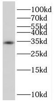 TGIF2LX Rabbit Polyclonal Antibody