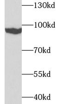 TGM1 Rabbit Polyclonal Antibody