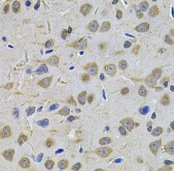 TGM1 Rabbit Polyclonal Antibody
