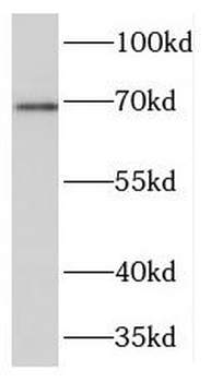 TGM4 Rabbit Polyclonal Antibody
