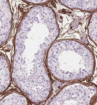 TGM4 Rabbit Polyclonal Antibody