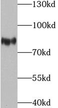 THOC1 Rabbit Polyclonal Antibody