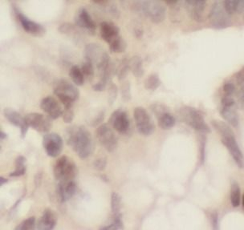 THOC1 Rabbit Polyclonal Antibody