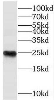 THOC7 Rabbit Polyclonal Antibody