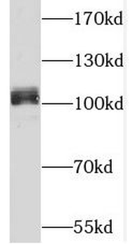 THBD Rabbit Polyclonal Antibody