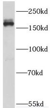 THBS1 Rabbit Polyclonal Antibody