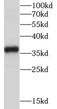 TYMS Rabbit Polyclonal Antibody