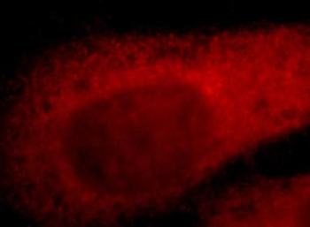 TYMS Rabbit Polyclonal Antibody