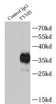 TYMS Rabbit Polyclonal Antibody