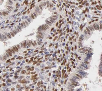 TYMS Rabbit Polyclonal Antibody